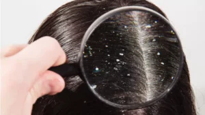 manfaat masker santan untuk rambut
